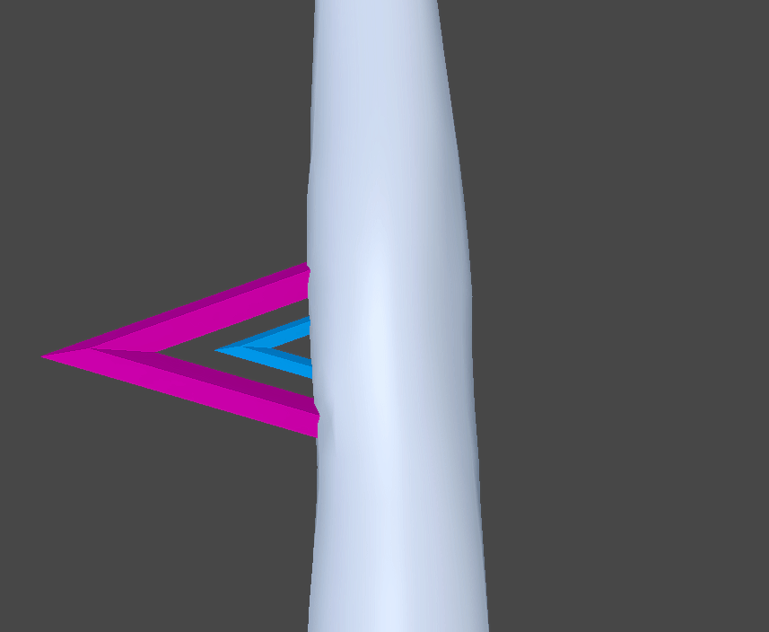 肘補助骨挙動アニメーション